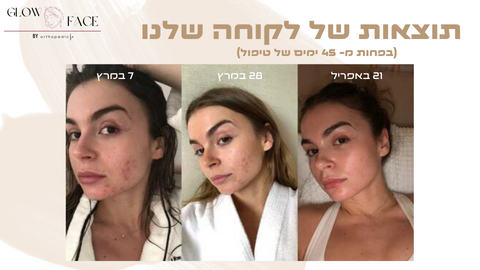 שרביט הקסם - למתיחה ושיקום עור הפנים