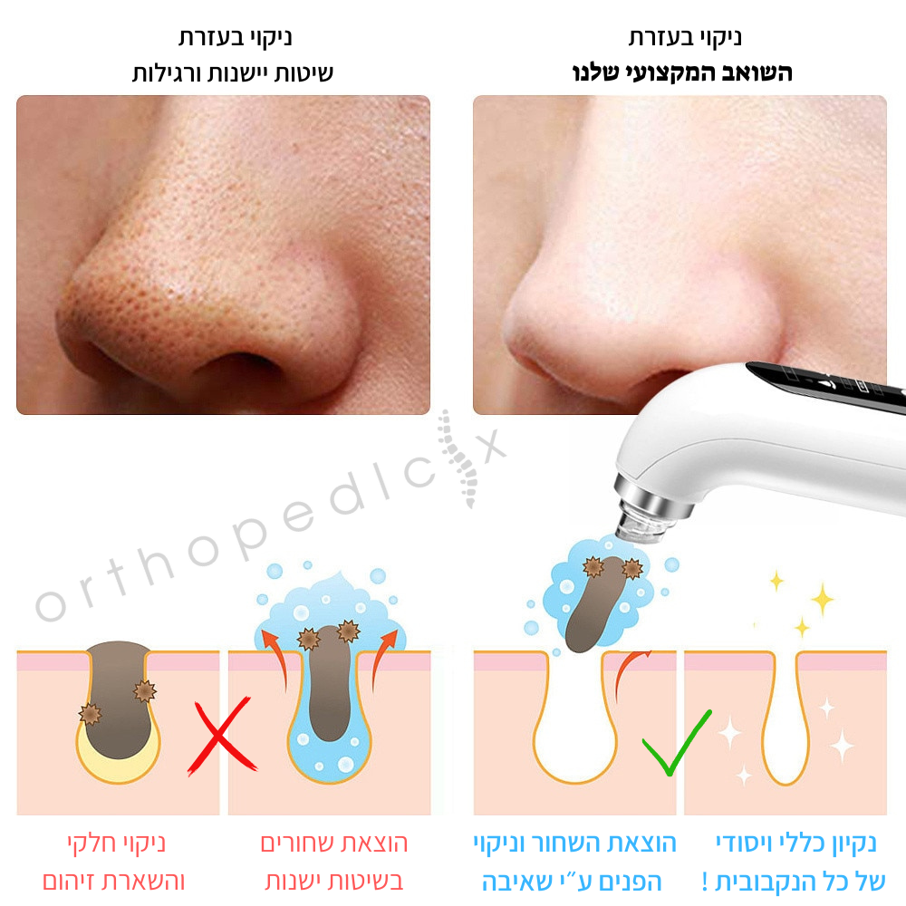 שואב השחורים ומנקה הפנים - Orthopedic-X | Glow Face